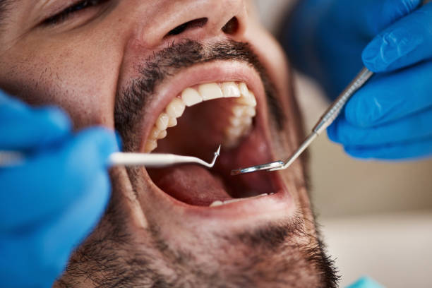 Best Emergency Tooth Extraction in Davisboro, GA
